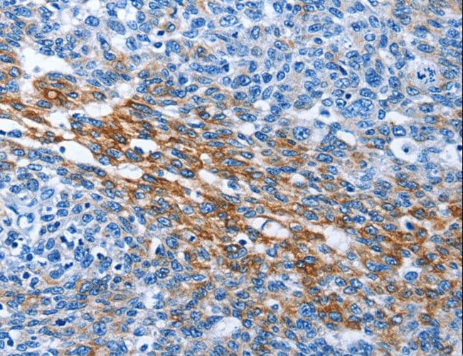 PAK6 Antibody