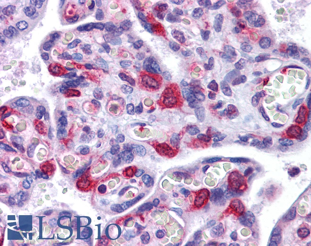 IHC-plus™ Polyclonal Rabbit anti-Human SH3RF2 Antibody (IHC, IF, WB)