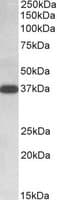 IHC-plus™ Polyclonal Goat anti-Human IDH3A Antibody (aa353-366, IHC, WB)