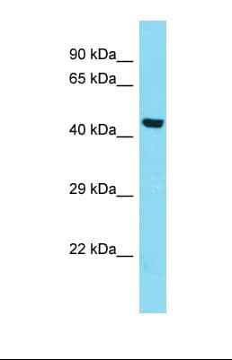 Polyclonal Rabbit anti-Human KIAA0141 Antibody (aa164-213, WB)