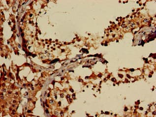 Polyclonal Rabbit anti-Human EIF2AK1 Antibody (IHC, IF, WB)