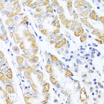 CDKN2C / p18 INK4c Antibody