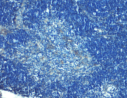 Polyclonal Rabbit anti-Human TLR8 Antibody (IHC)