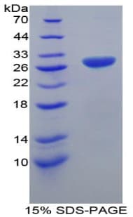 Mouse TRAF1 Protein (Recombinant His-T7)