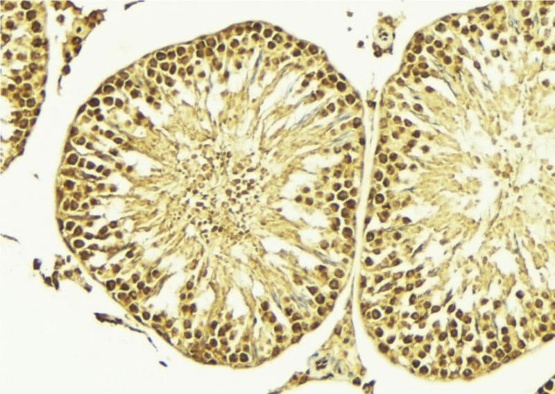 Polyclonal Rabbit anti-Human NKX3-1 Antibody (IHC, WB)