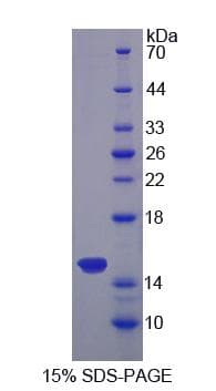 Mouse SFXN1 Protein (Recombinant His-S)