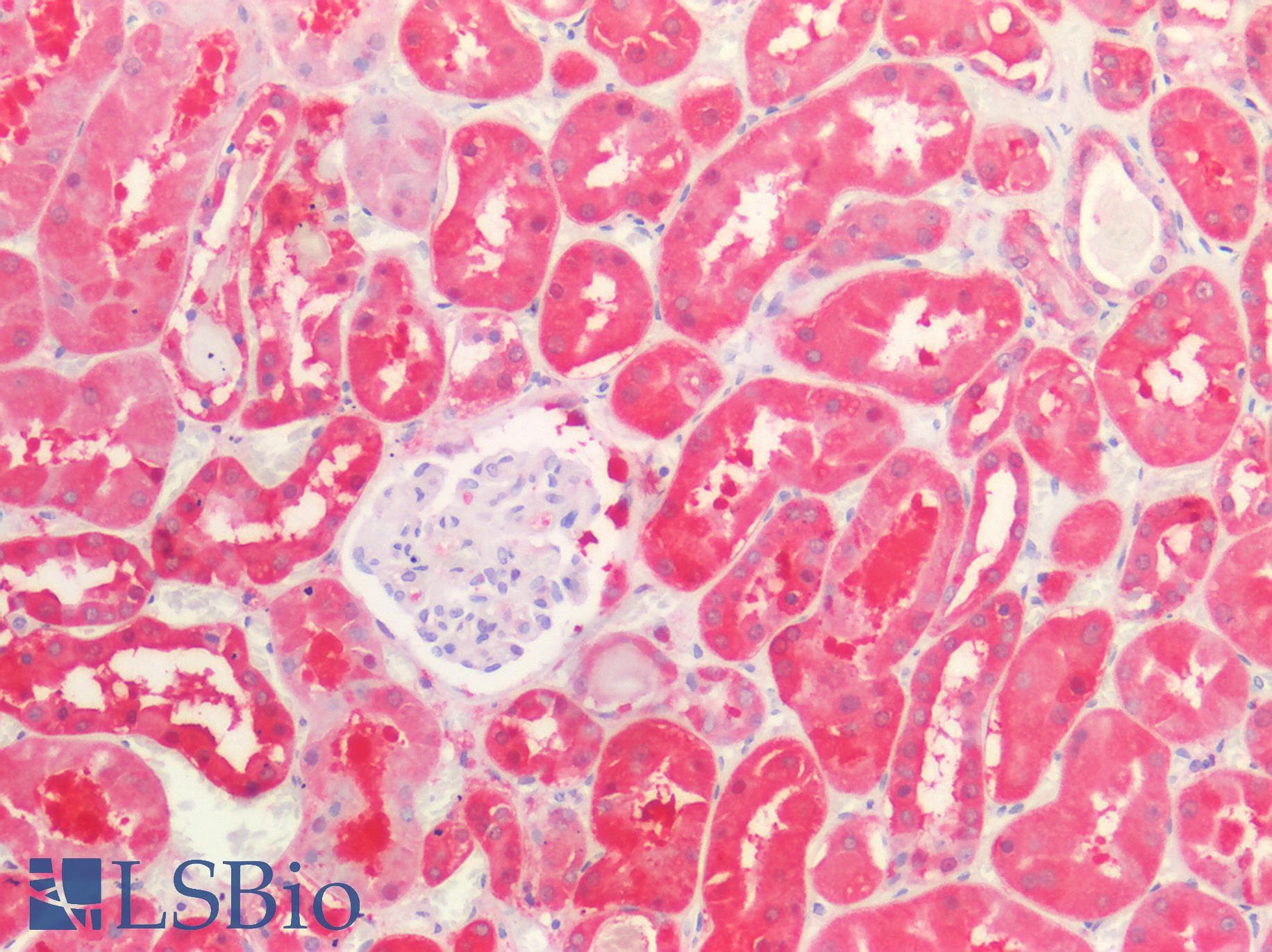 PathPlus™ Monoclonal Mouse anti-Human ALDH1A1 / ALDH1 Antibody (clone 5A11, IHC, WB)