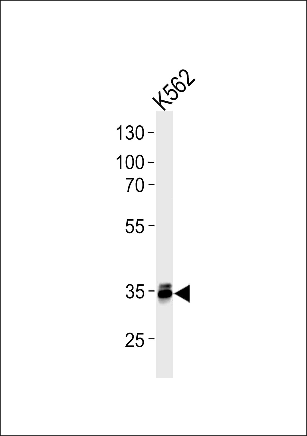MBD3 Antibody (clone 995CT3.2.2)