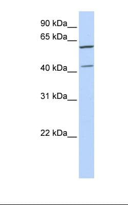 POLDIP3 / p46 Antibody (aa326-375)