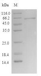 Human SLFN12 Protein (Recombinant 6His, N-terminus)