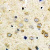 NODAL Antibody (C-Terminus)