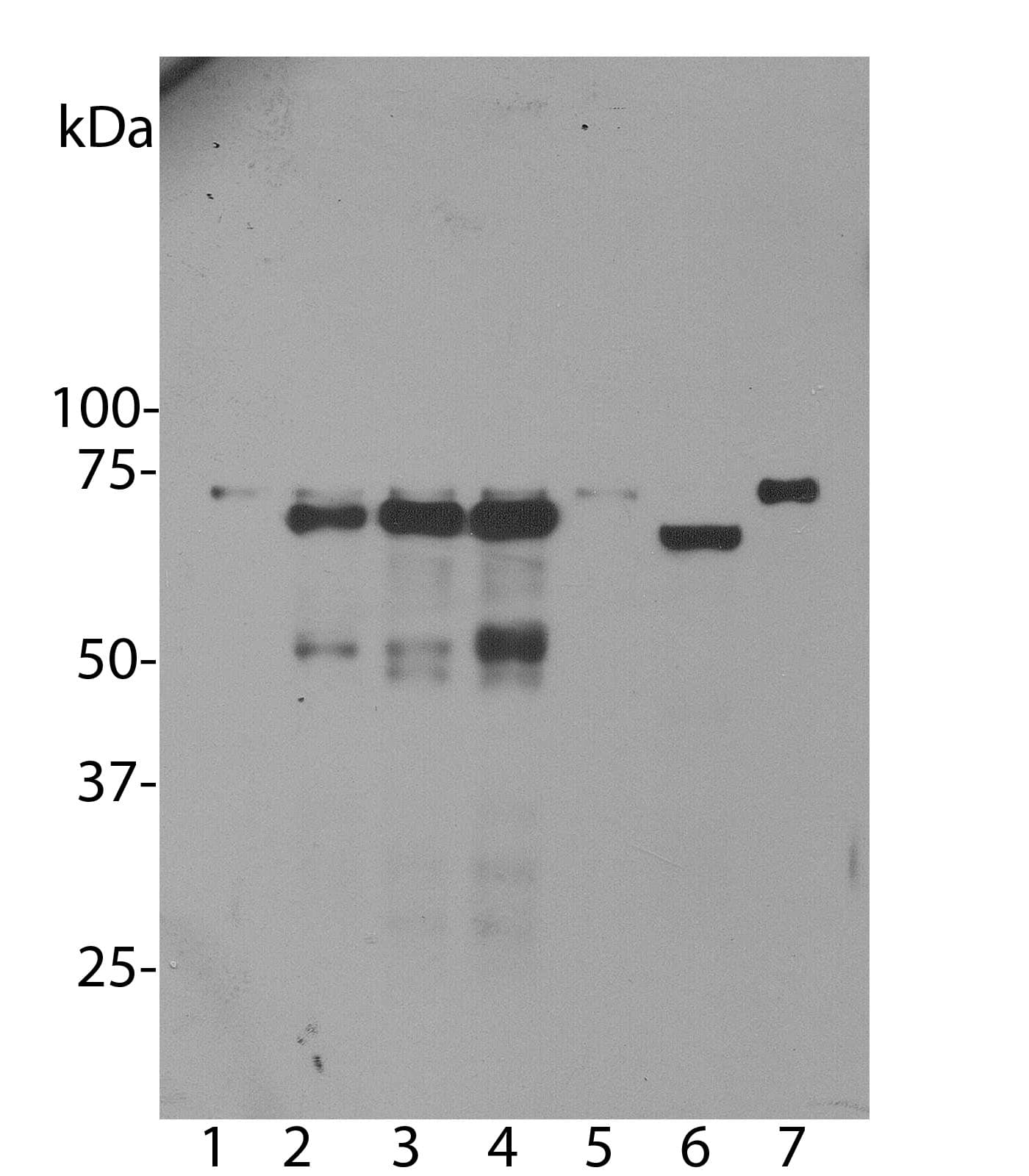 Monoclonal Mouse anti-Human Ubiquilin 2 / UBQLN2 Antibody (clone 6H9, IF, WB)