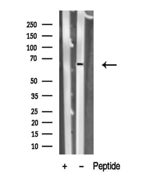 PNKP Antibody