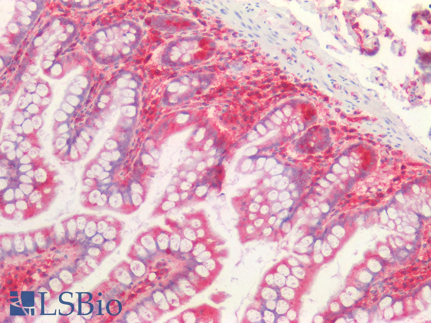 PathPlus™ B2M / Beta 2 Microglobulin Antibody (aa21-119, clone OTI1A7)