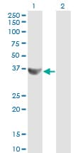 CCNG2 / Cyclin G2 Antibody (clone 1F9-C11)