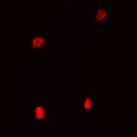 Polyclonal Rabbit anti-Human COIL / Coilin Antibody (IF, WB)