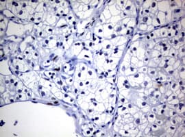 ZEB2 / SIP-1 Antibody (clone OTI15G8)