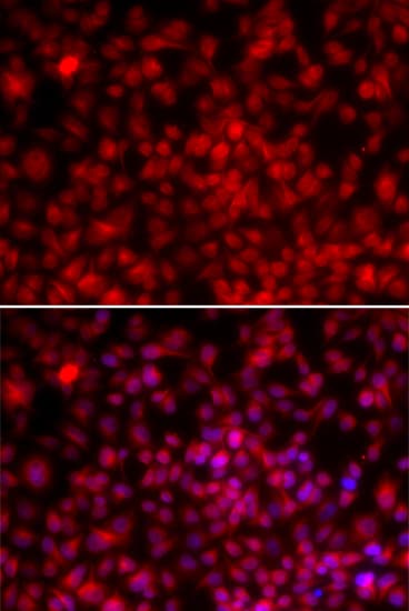 Polyclonal Rabbit anti-Human NF45 / ILF2 Antibody (IHC, IF, WB)