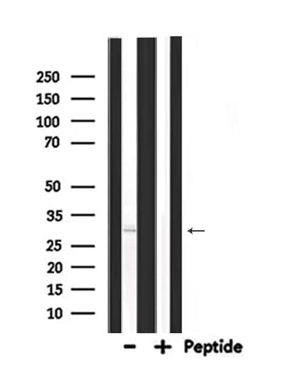 PDX1 Antibody
