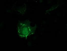PDLIM2 / SLIM Antibody (clone OTI11A12)