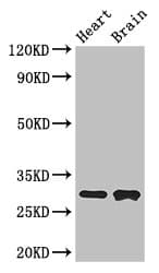 Polyclonal Rabbit anti-Human FcERI / Fc Epsilon RI Antibody (IHC, IF, WB)