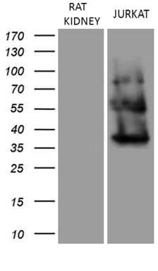 Monoclonal Mouse anti-Human URP2 / FERMT3 Antibody (clone OTI2H10, aa259-528, IHC, WB)