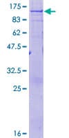 Human ALDP / ABCD1 Protein (Recombinant GST)