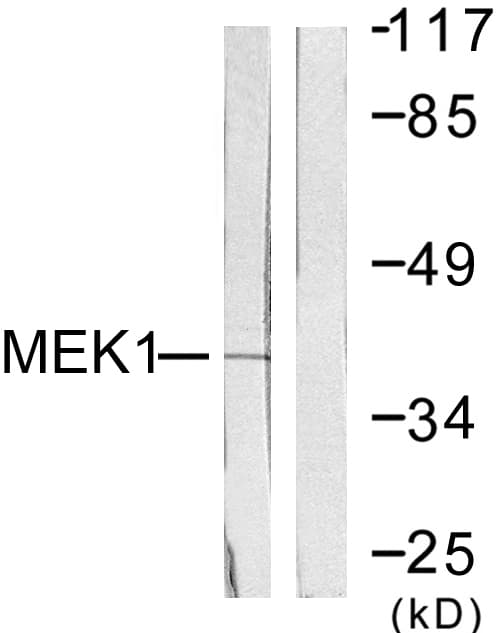IHC-plus™ Polyclonal Rabbit anti-Human MAP2K1 / MKK1 / MEK1 Antibody (aa252-301, IHC, WB)