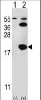 Polyclonal Rabbit anti-Human UBE2I / UBC9 Antibody (aa1-30, IHC, WB)