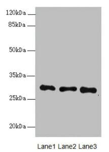 Polyclonal Rabbit anti-Human MEOX1 Antibody (IHC, WB)