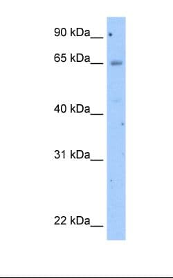 Polyclonal Rabbit anti-Human OCLN / Occludin Antibody (N-Terminus, WB)