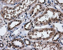 Heat Shock Protein 70 / HSPA1A Antibody (clone OTI2C12)