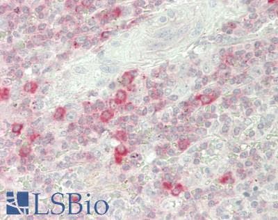 IHC-plus™ TRAIL-R4 / DCR2 Antibody (aa105-154)