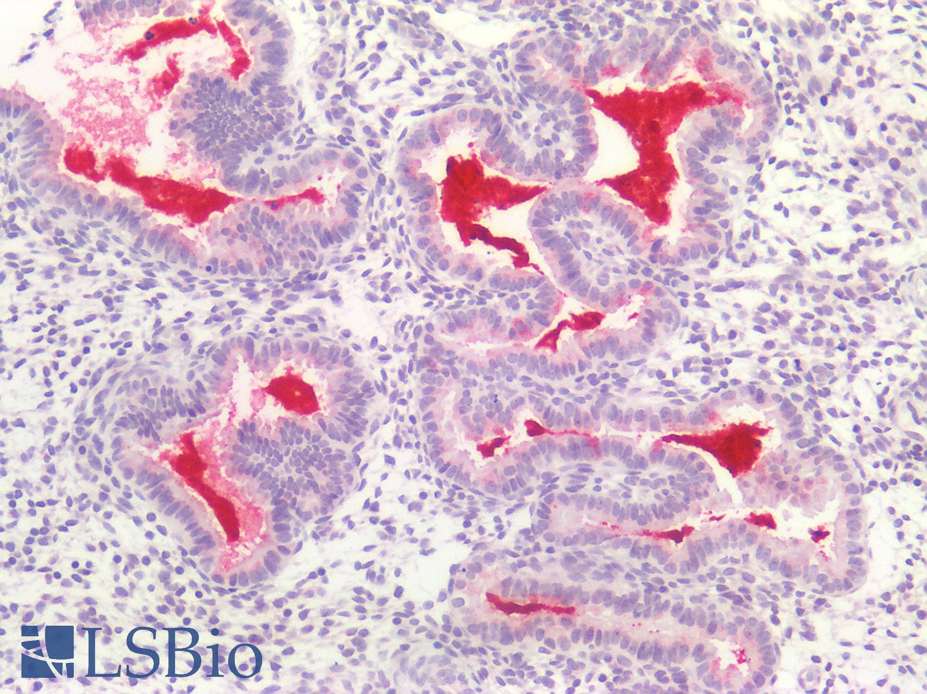 PathPlus™ ACVRL1 Antibody (aa196-245)