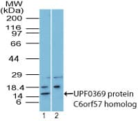 SDHAF4 Antibody (aa75-104)