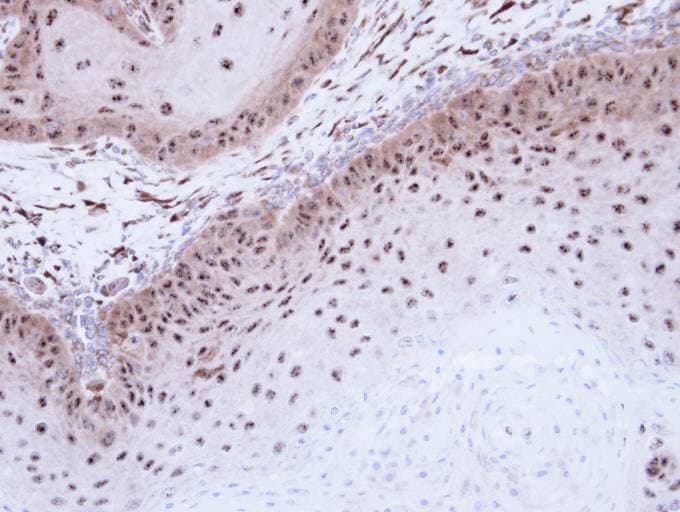 DMC1 Antibody (aa1-206)