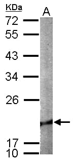 Polyclonal Rabbit anti-Human CFL2 / Cofilin 2 Antibody (aa1-166, WB)