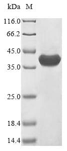 Naja kaouthia Alpha-cobratoxin (Naja siamensis) Protein (Recombinant 10His-GST, N-terminus + Myc, C-terminus)