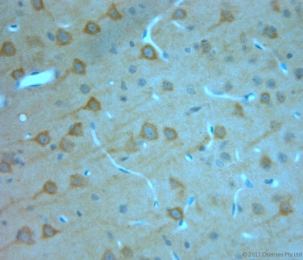 Polyclonal Rabbit anti-Human ITPR1 / IP3 Receptor Type 1 Antibody (aa700-750, IHC)