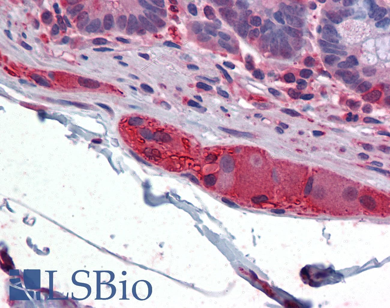 IHC-plus™ TUBB2A / Tubulin Beta 2A Antibody (clone 2B2)