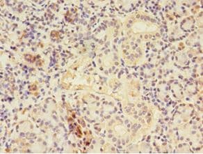CTPS Antibody (aa79-388)