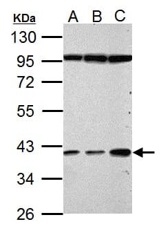 Polyclonal Rabbit anti-Human HP / Haptoglobin Antibody (aa129-375, WB)