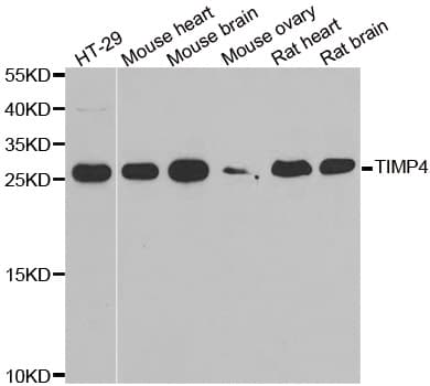 Polyclonal Rabbit anti-Human TIMP4 Antibody (IHC, IF, WB)