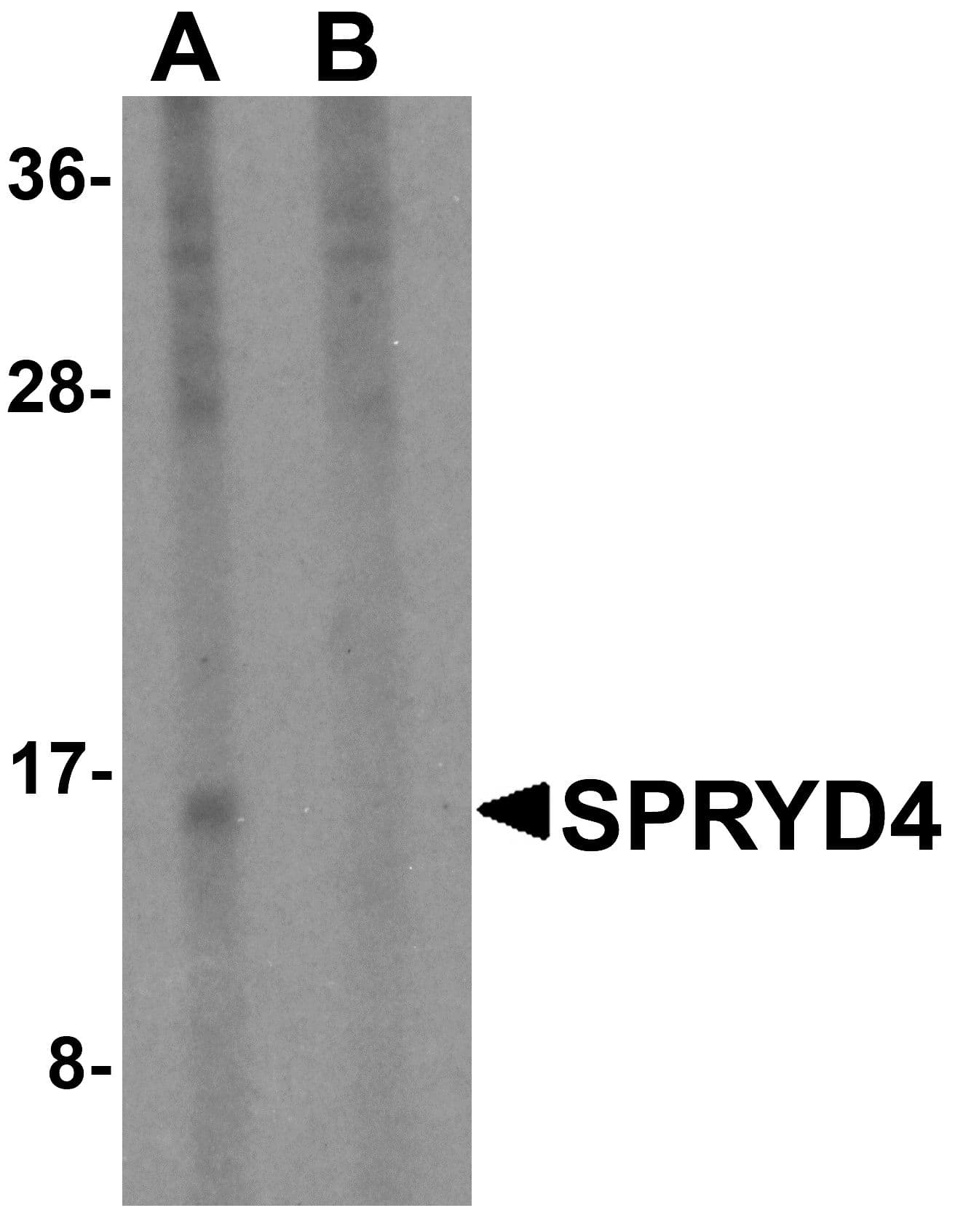 Polyclonal Rabbit anti-Human SPRYD4 Antibody (IHC, IF, WB)