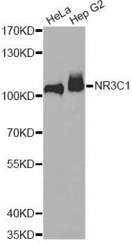 NR3C1/Glucocorticoid Receptor Antibody