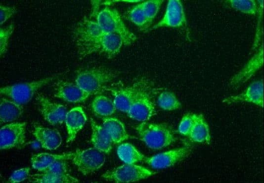 PC / Pyruvate Carboxylase Antibody (aa930-1050, DY488)