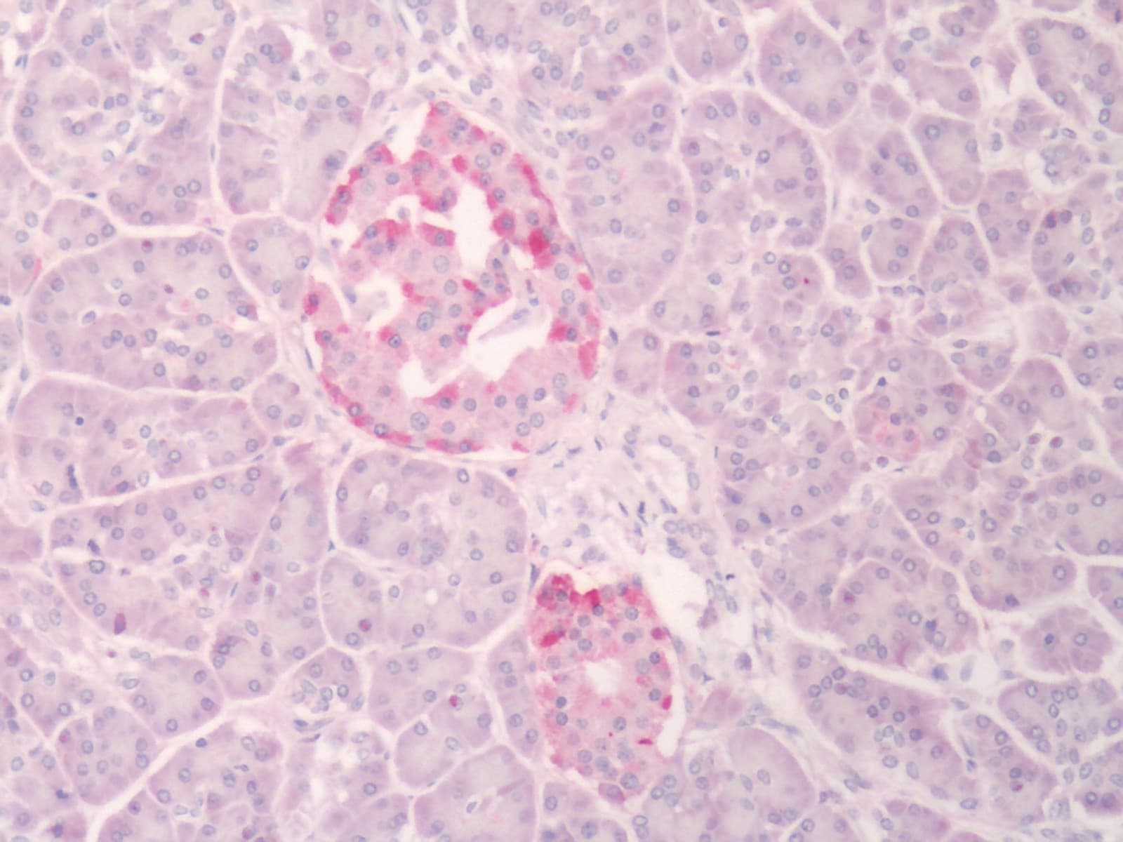 IHC-plus™ Polyclonal Rabbit anti-Human INSR / Insulin Receptor Antibody (Internal, IHC)