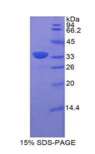 Rat CD157 Protein (Recombinant His-T7)