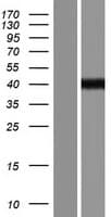 Human DMD / Dystrophin Protein (Over-Expression Lysate Myc-DDK (Flag))
