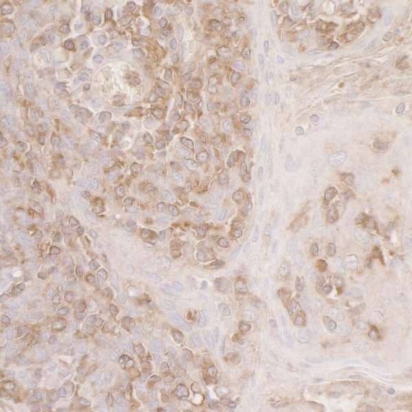 ACTR2 / ARP2 Antibody (aa250-300)